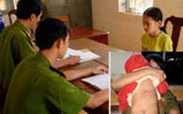 Bảo mẫu hành hạ trẻ 9 tháng tuổi vì... ghen!